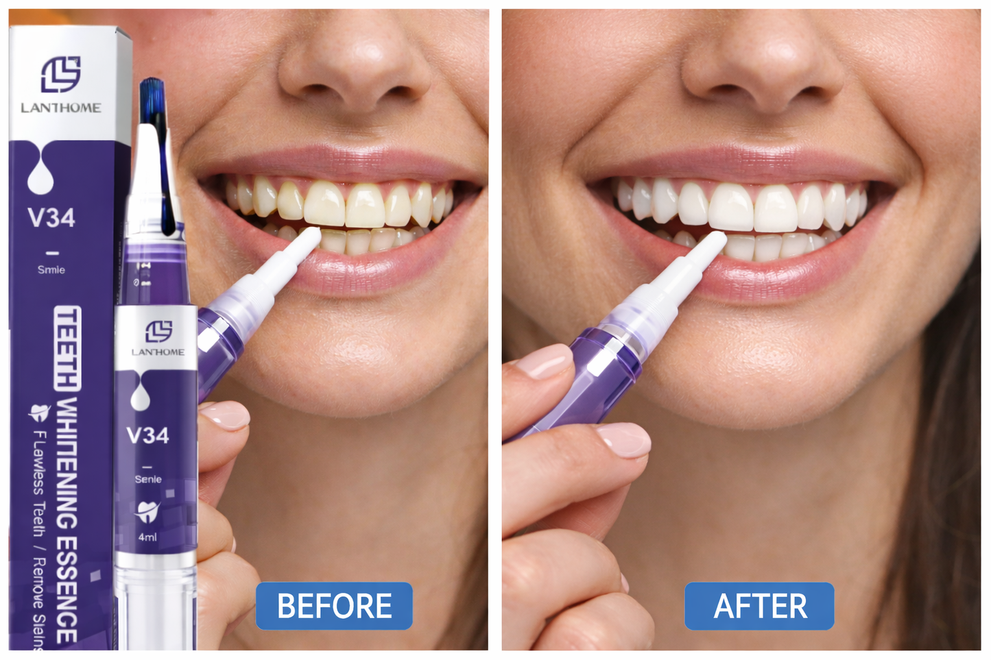 Violet Smile Whitening Pen